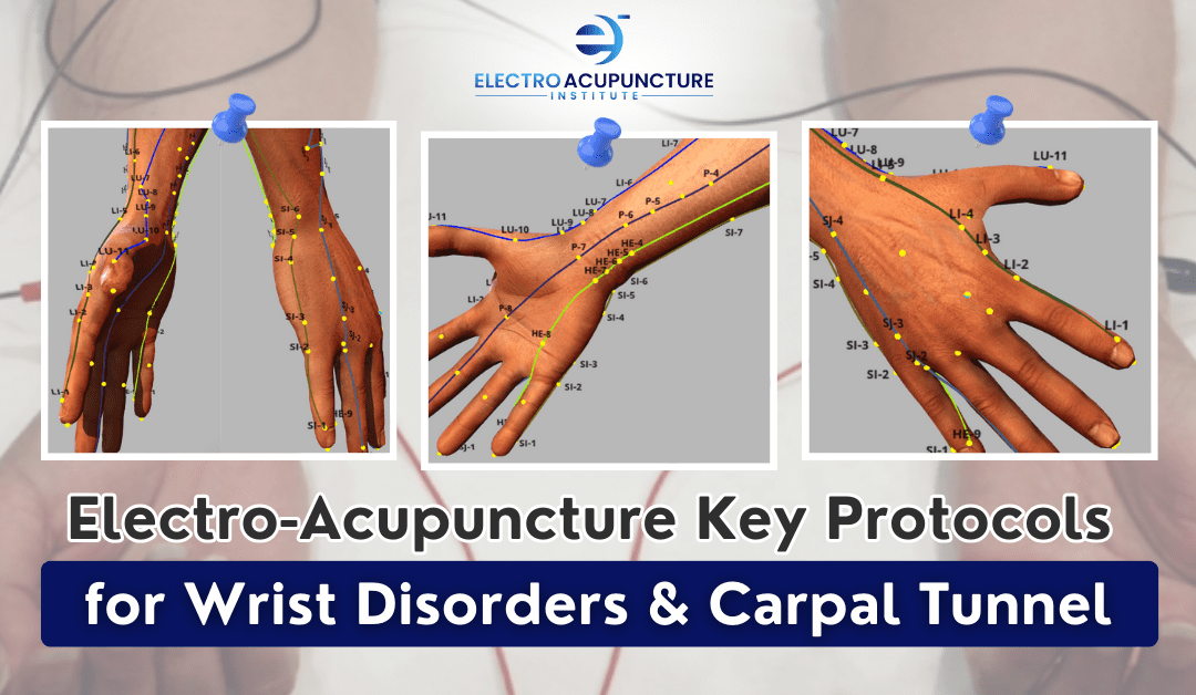 Electro-Acupuncture Key Protocols for Wrist Disorders & Carpal Tunnel